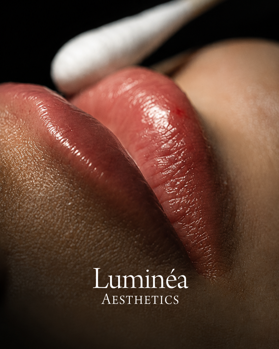 Lippen – Nahaufnahme Ergebnis